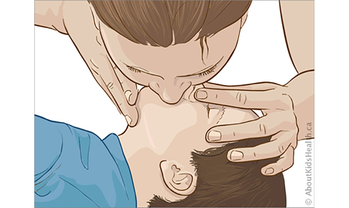 Adult performing CPR on child