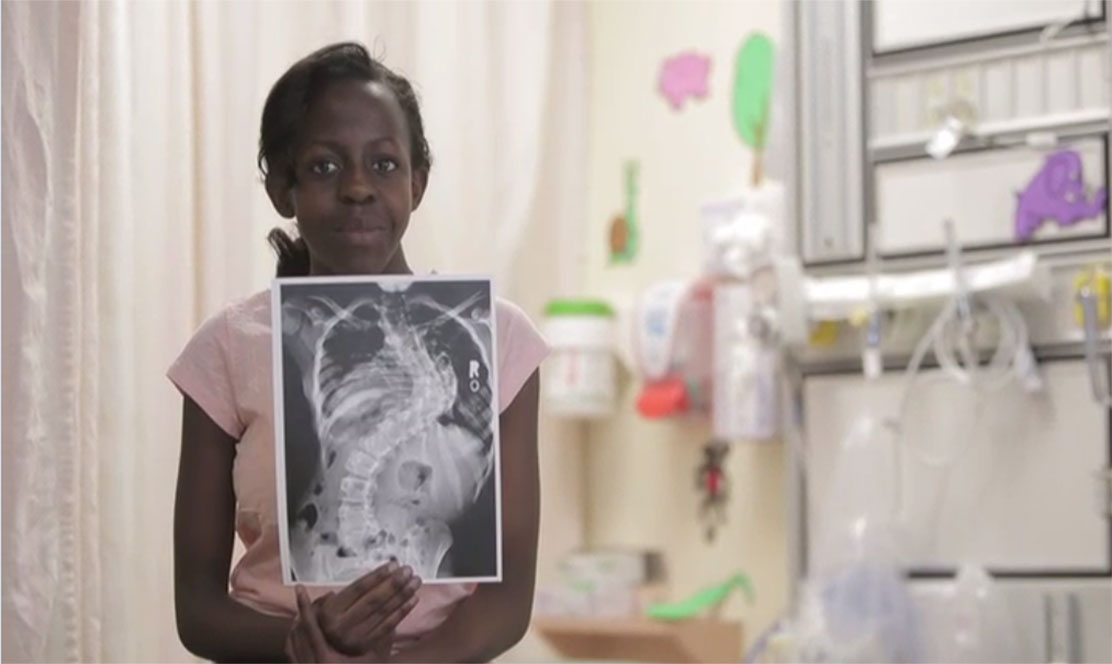 Patient holding an x-ray of her spine