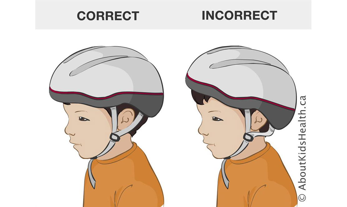 Diagram of a helmet sitting on a child's head properly and improperly