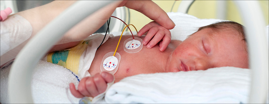 Baby sleeping in NICU bed