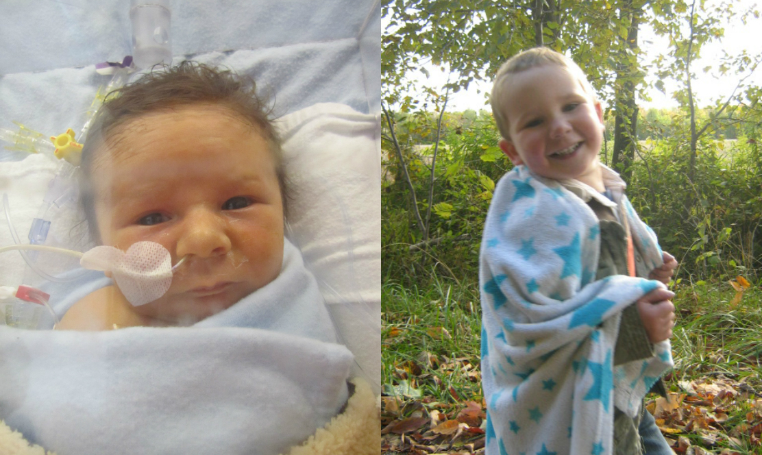 SickKids patient at birth in the hospital and at home as a little boy wrapped in a towel